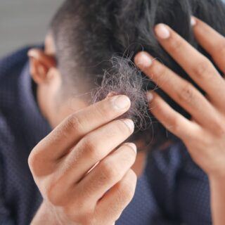 Haarausfall bei Männern Haarausfall bei Männern - Ursachen und Behandlung
