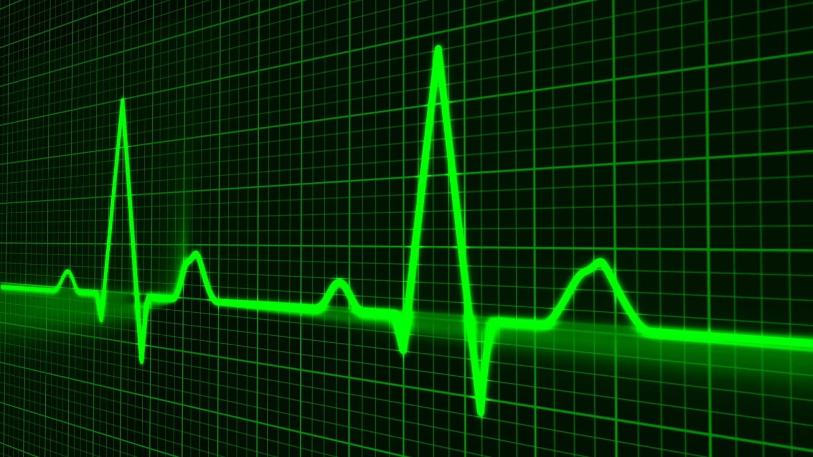 Herzrhythmusstörungen - Ursachen, Symptome und Behandlung